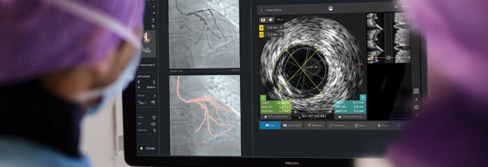 Cad treatment popup intrasight