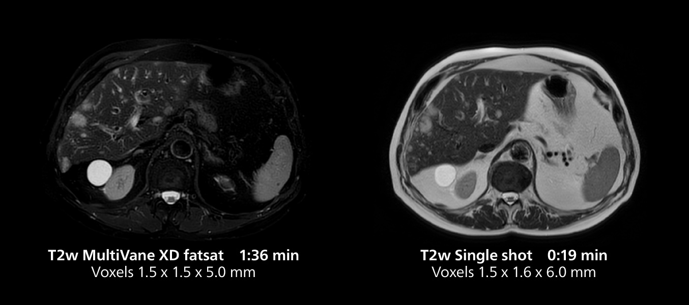 Knee mri three