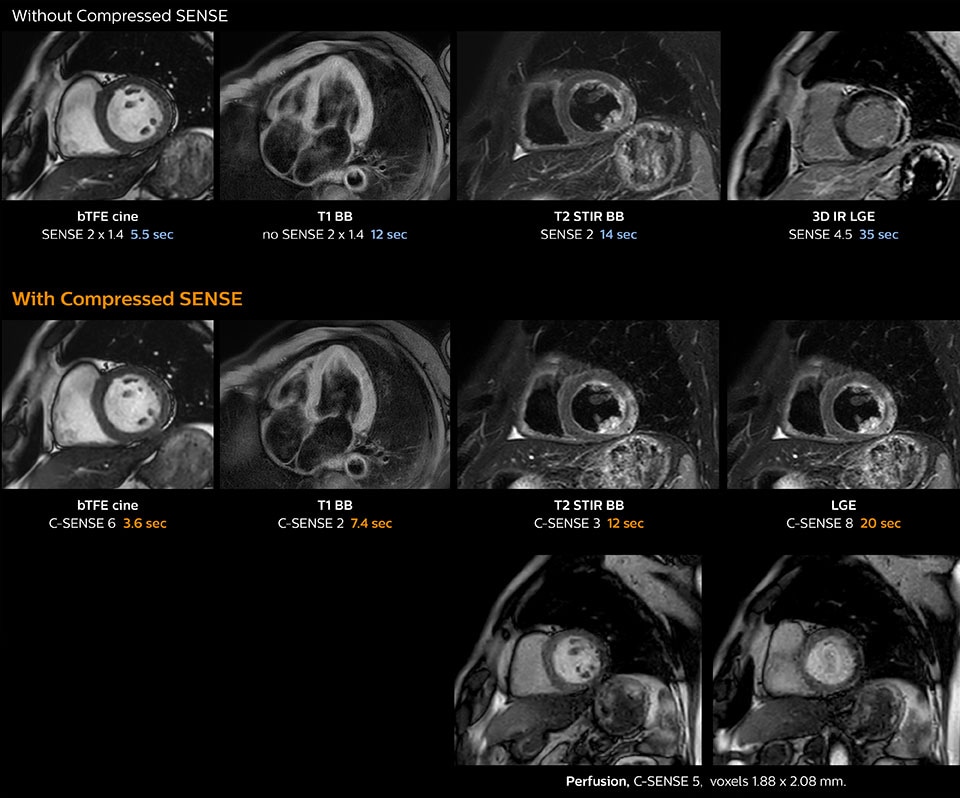 clinical image cardiac mri compressed sense desktop
