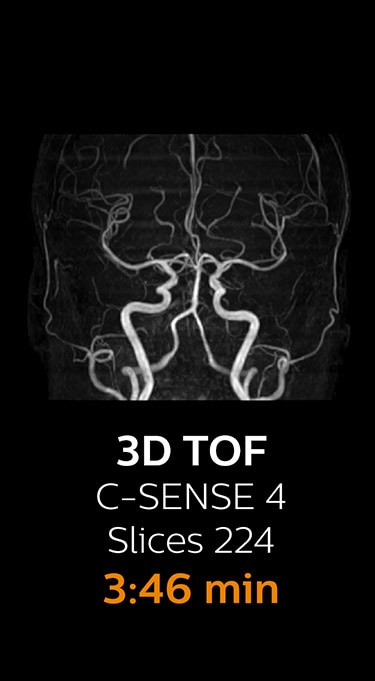 3D TOF