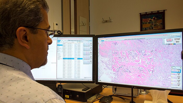 Digital Pathology | Philips Healthcare
