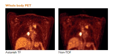 comparison TOF images