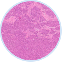 Histopathology image
