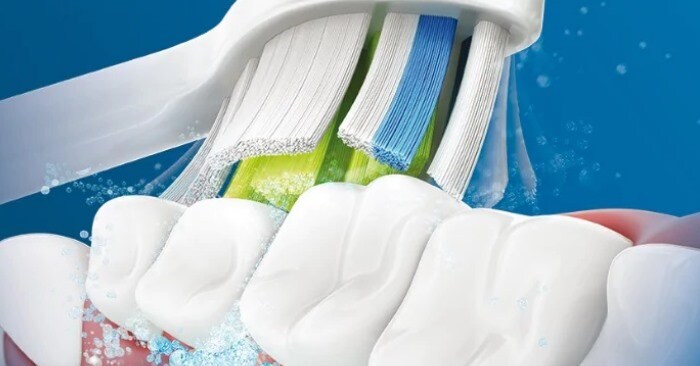 Piękne białe zęby domowe sposoby